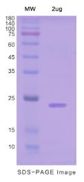 SDS-PAGE (STAT6-6368H).jpg